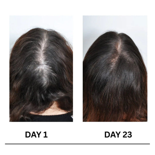 Il cuoio capelluto stimola la crescita dei capelli
