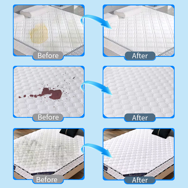 🎉Hot Sale 30% OFF🎉 Powerful Mattress Yellow Stain Cleaner
