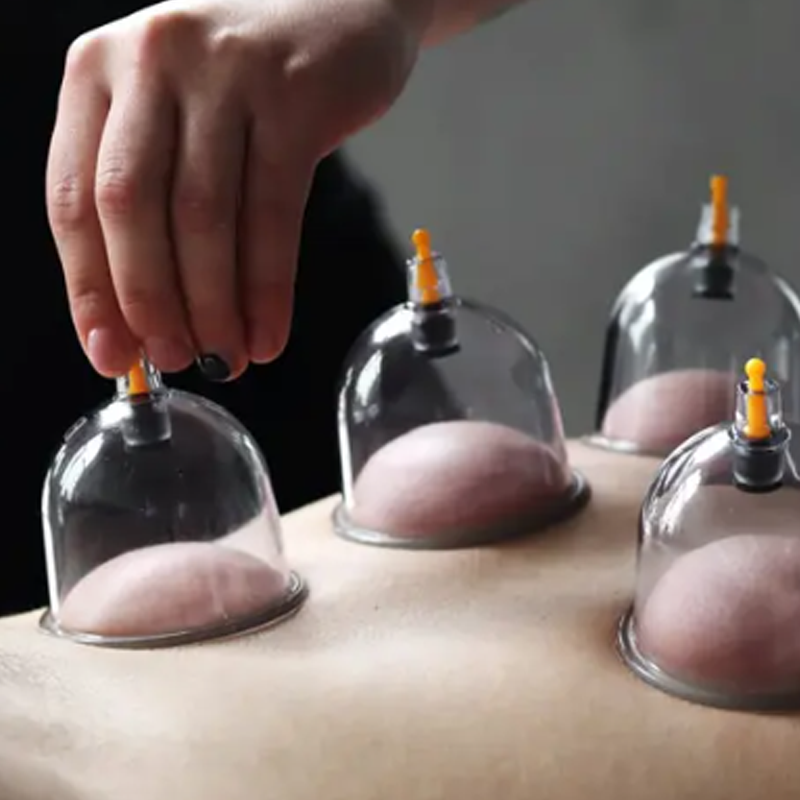 🧬 LIMITED-TIME 50% OFF! ✨ Vacuum Cupping Therapy Set – Thickened, Suction Pump, Transparent 🩺