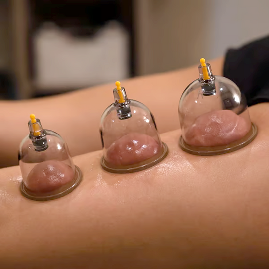 🧬 LIMITED-TIME 50% OFF! ✨ Vacuum Cupping Therapy Set – Thickened, Suction Pump, Transparent 🩺