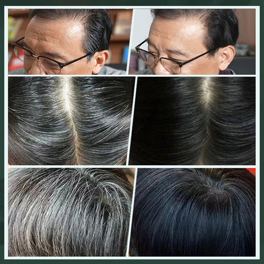✨ German Plant-Based Hair Dye for Salon-Perfect Roots – 100% Plant Power, Easy to Use & Covers Gray Hair in 5 Minutes 🌿